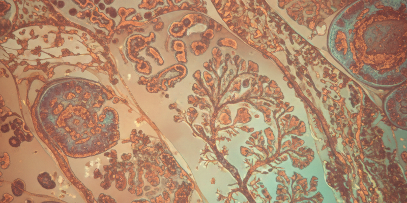 النحاس في الأنسجة