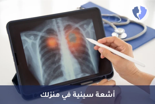 أشعة سينية منزلية (X-Ray)