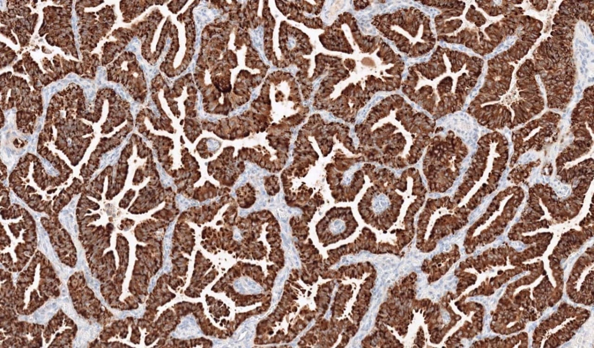 Immunohistochemistry: ROS1