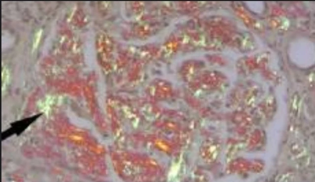 Special Stain: Congo Red