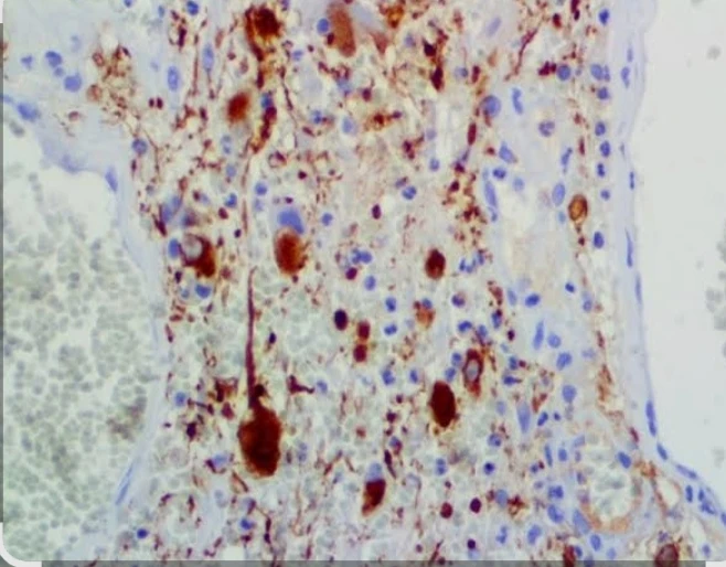 Immunohistochemistry: Neurophilament
