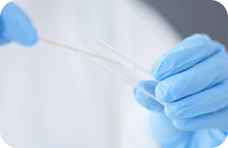 Qualitative detection of Neisseria gonorrhoeae by Real Time - PCR.