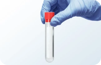 Qualitative detection of Herpes simplex virus 1 (HSV-1) by Real Time - PCR.
