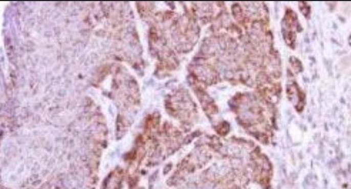Immunohistochemistry: Arginase-1