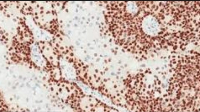 Immunohistochemistry: Androgen Receptor