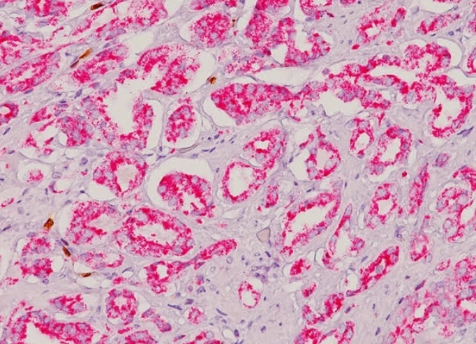 Immunohistochemistry: AMACR (P504S)