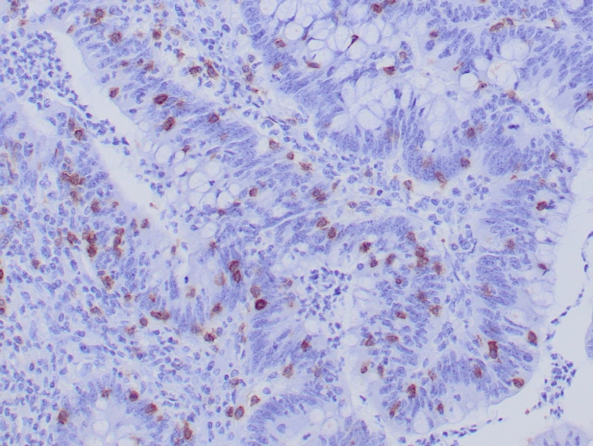 Immunohistochemistry: CD103