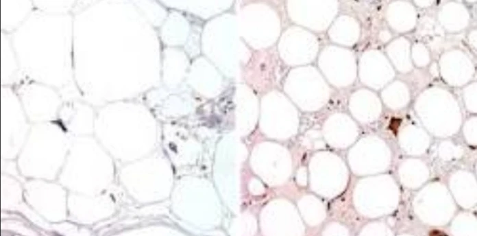 Immunohistochemistry: CDK4