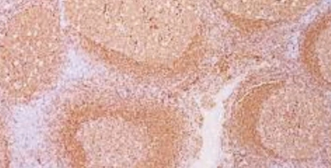 Immunohistochemistry: CD79A