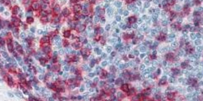 Immunohistochemistry: CD43