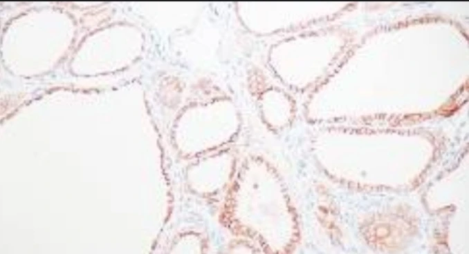Immunohistochemistry: CD56 (Natural Killer Cells)