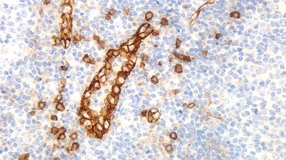 Immunohistochemistry: CD123