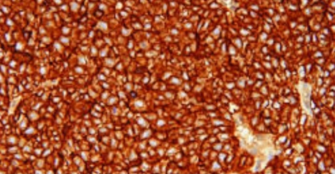 Immunohistochemistry: CD99
