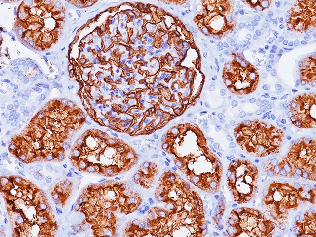 Immunohistochemistry: CD10