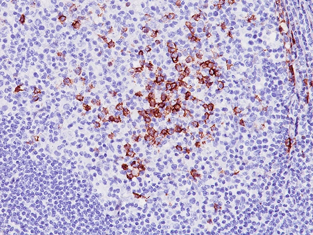 Immunohistochemistry: CD138