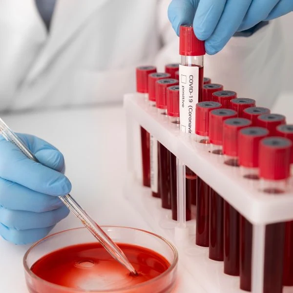 Culture & Sensitivity - Blood