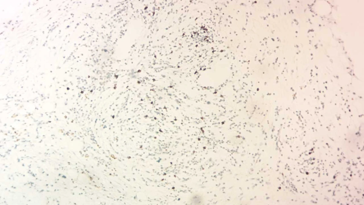 Immunohistochemistry: Interpretation and Consultation (13 Marker)