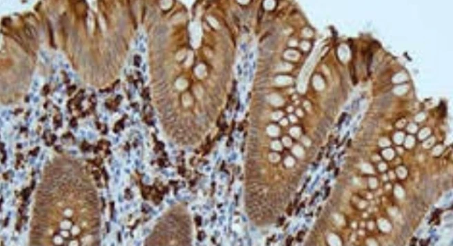 Immunohistochemistry: IgA
