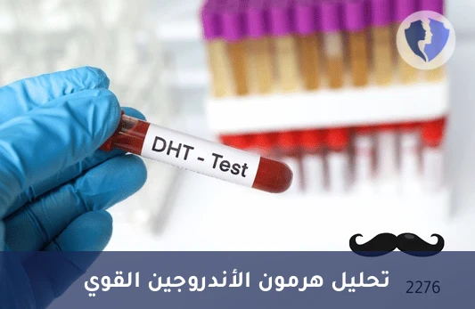تحليل هرمون ديهيدروتستوستيرون (DHT)