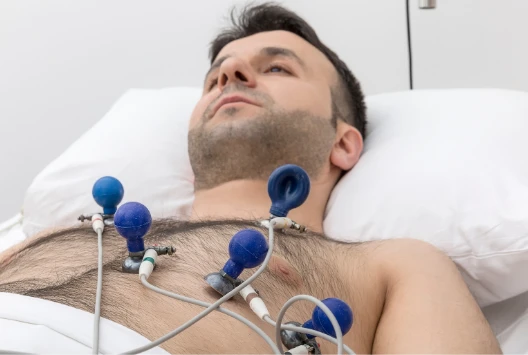 Home electrocardiography (ECG)