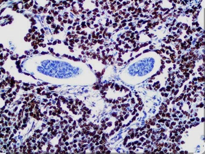 Immunohistochemistry: SALL4