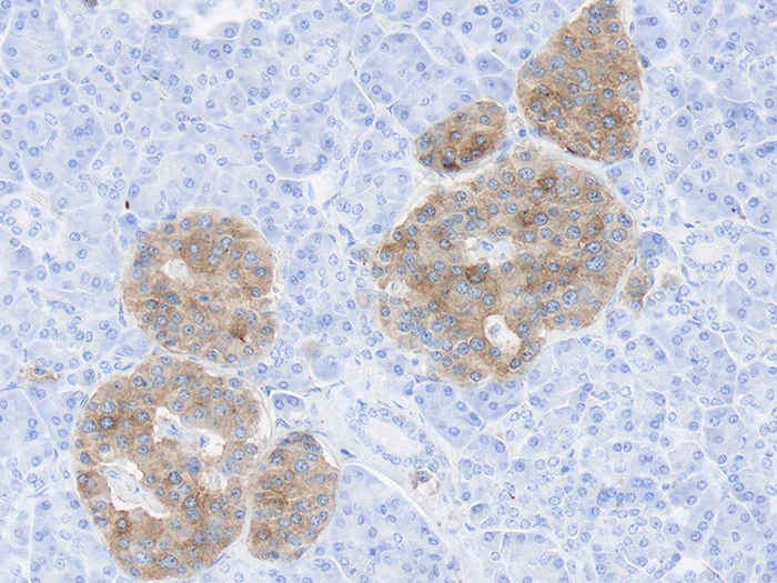 Immunohistochemistry: Synaptophysin