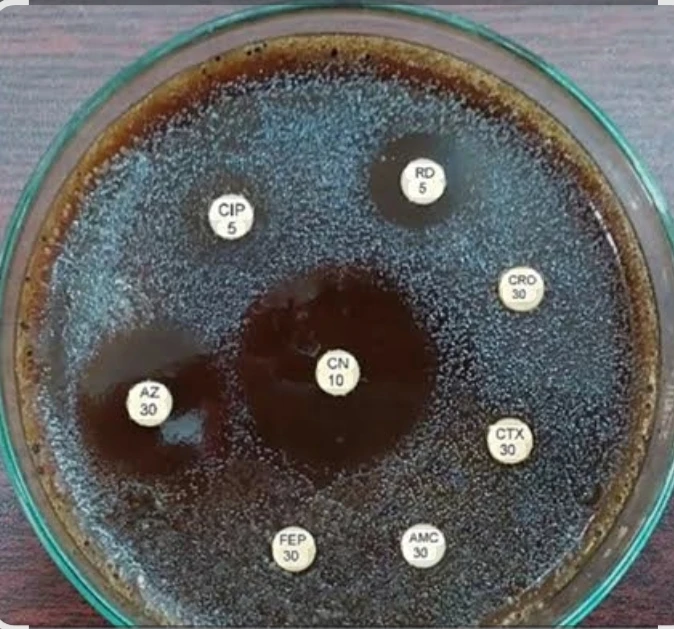 Culture & Sensitivity - Urethral Discharge