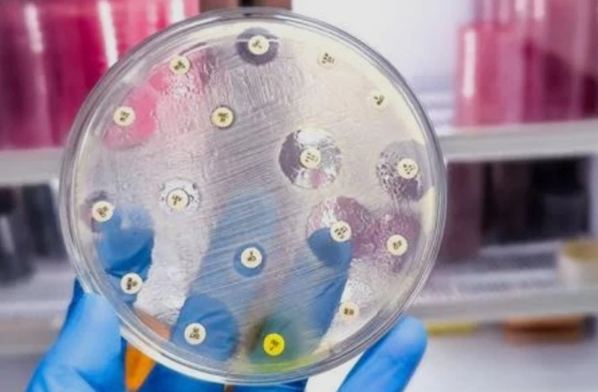 Culture & Sensitivity - Prostatic