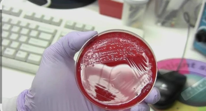 Culture & Sensitivity - Sputum