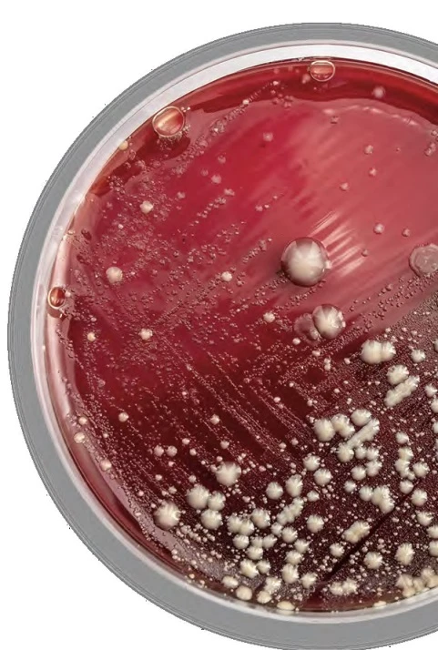 Culture & Sensitivity - Stool