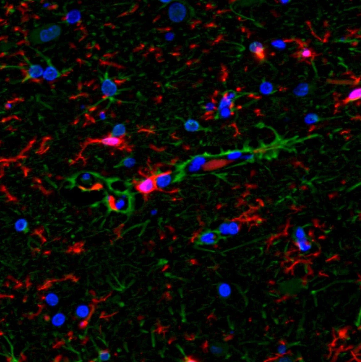 Immunohistochemistry: Interpretation and Consultation (4 Marker)