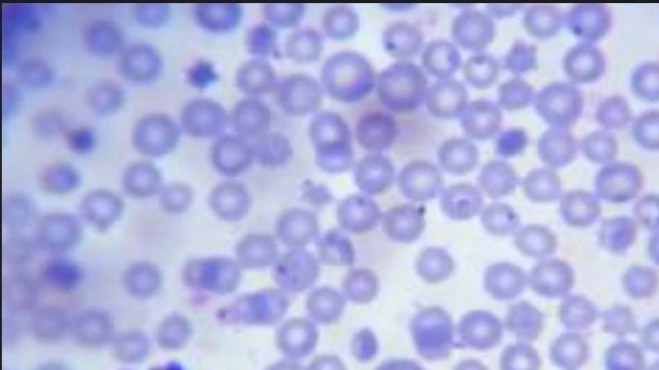 Special Stain: Giemsa Stain