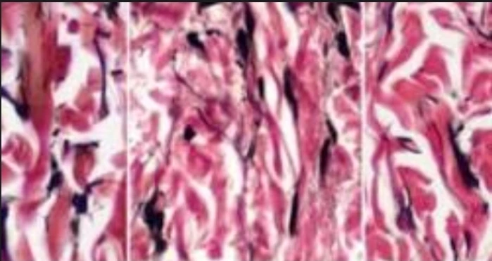 Special Stain: Elastic Stain (Van Gieson's)