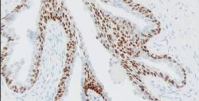 Immunohistochemistry: P63