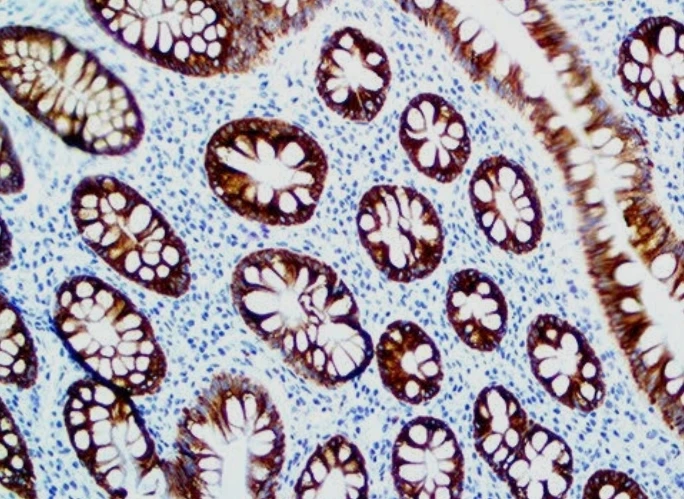 Immunohistochemistry: MUC4