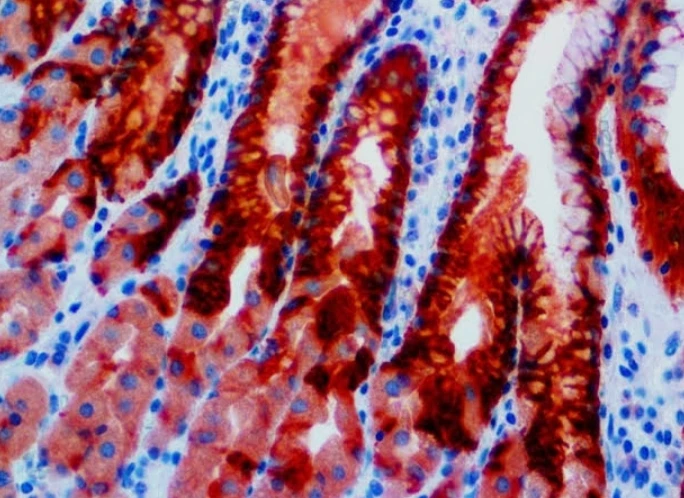 Immunohistochemistry: MUC5AC