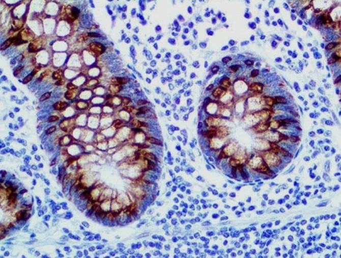 Immunohistochemistry: MUC2
