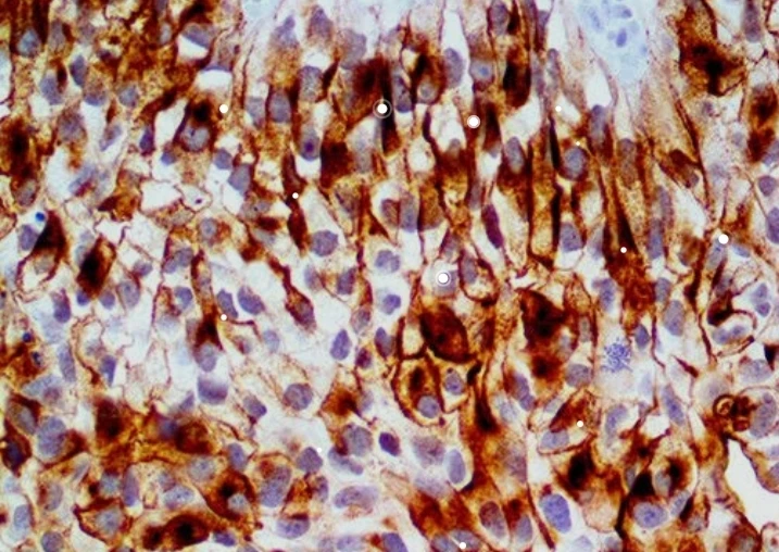 Immunohistochemistry: Uroplakin