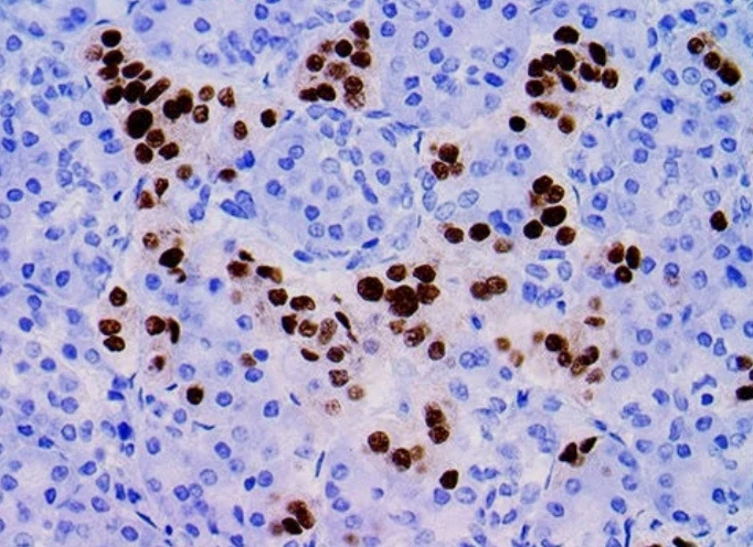 Immunohistochemistry: NKX2.2