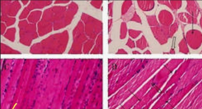 Skeletal Muscle, ABS