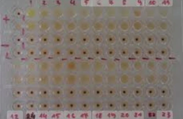 Treponema Pallidum (TPHA), Titer