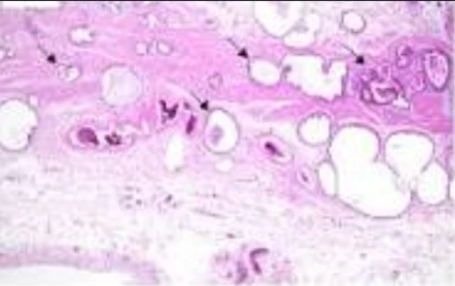 Immunohistochemistry: MSI