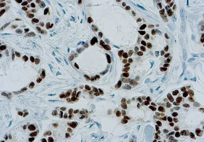 Immunohistochemistry: ER