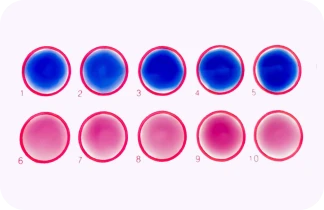 Widal Test (Salmonella)