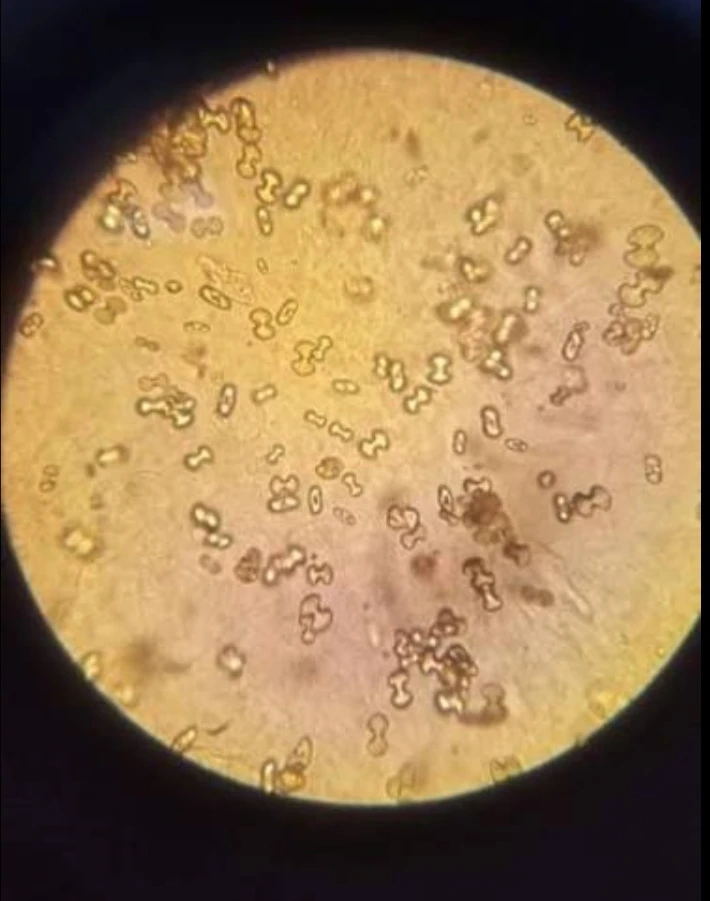 Oxalic Acid (Oxalate), Plasma