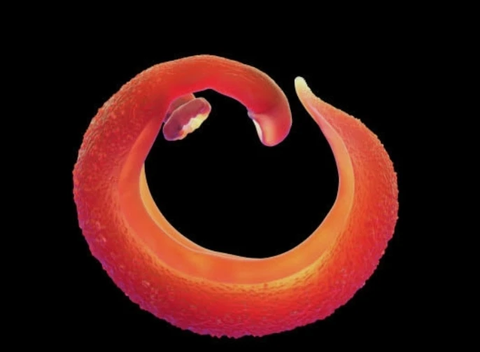 Schistosoma Ab IgG