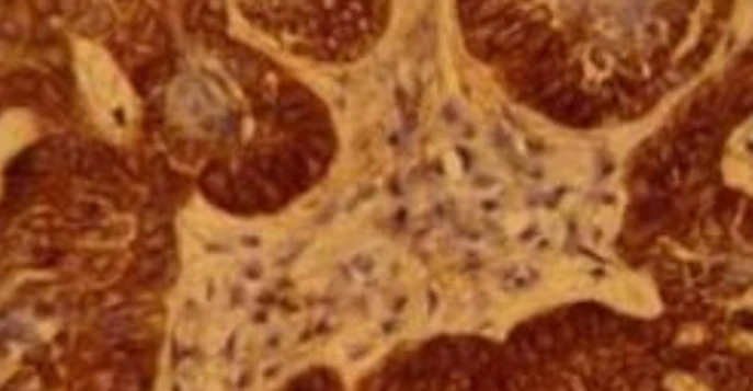 Immunohistochemistry: BerEP4