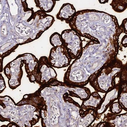 Immunohistochemistry: Placental Alkaline Phosphatase (PLAP)