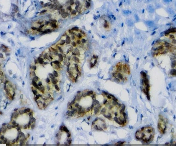 Immunohistochemistry: BAP1