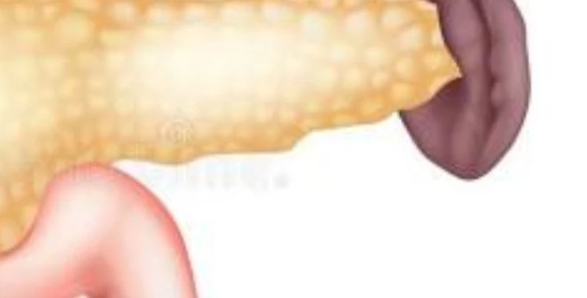 Insulinoma Associated Abs